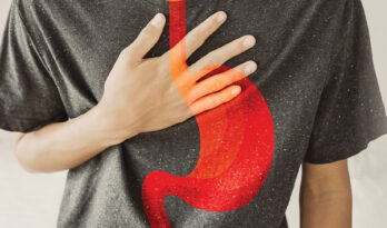 Managing Acid Reflux to Avoid Cancer